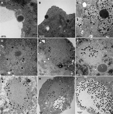 Clandestinovirus: A Giant Virus With Chromatin Proteins and a Potential to Manipulate the Cell Cycle of Its Host Vermamoeba vermiformis